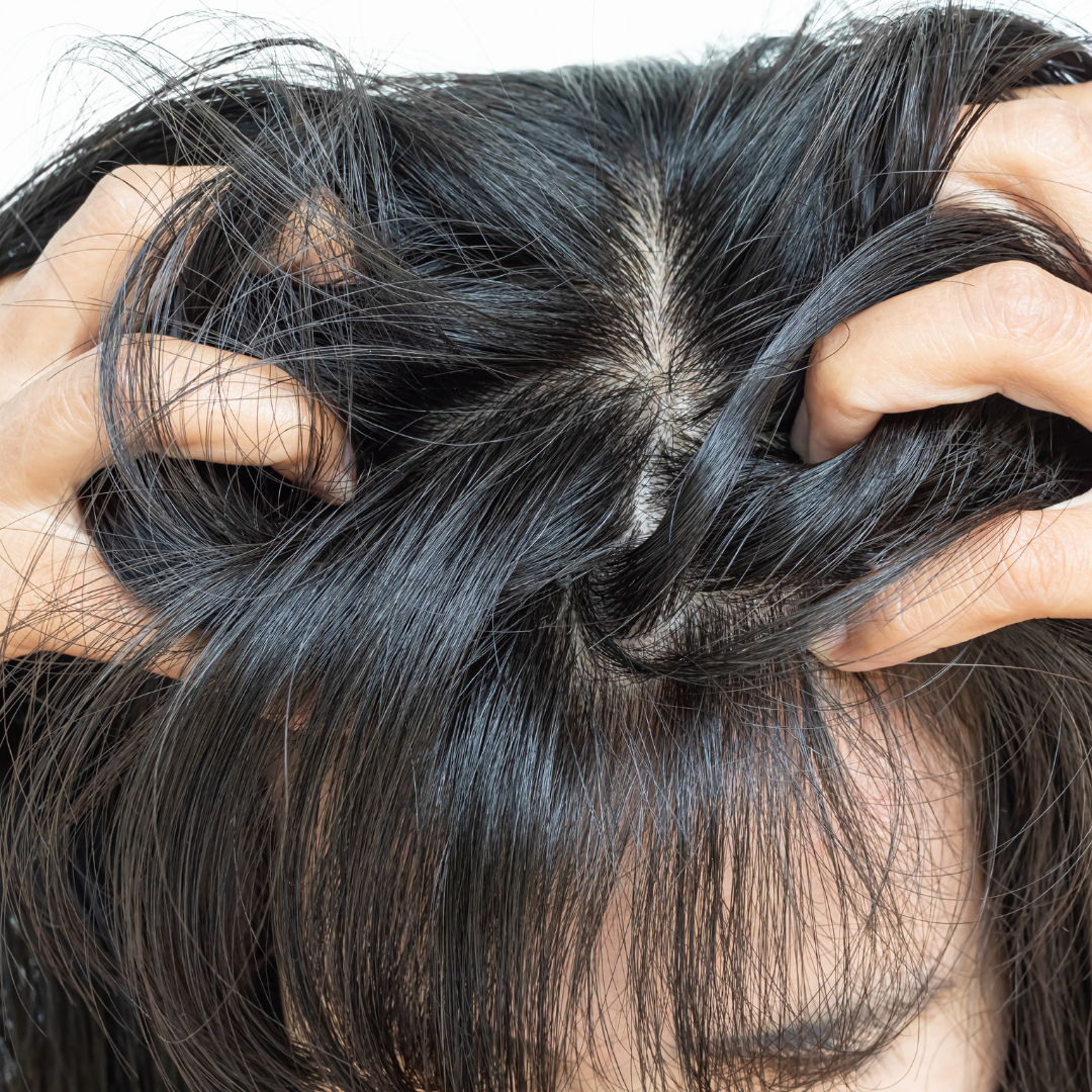 Cuir chevelu sec : que faire ? 10 solutions naturelles qui marchent