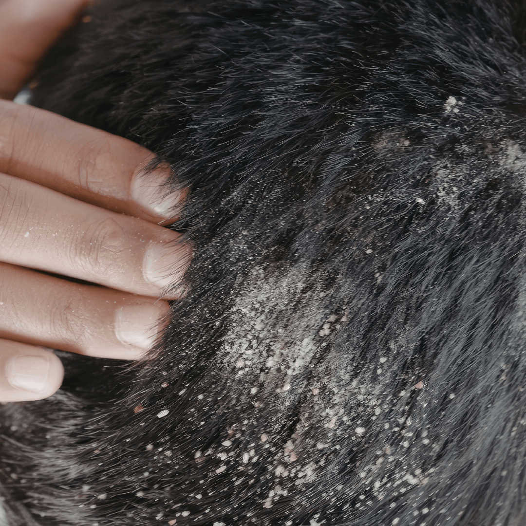 Irritation du cuir chevelu : causes, symptômes et solutions naturelles