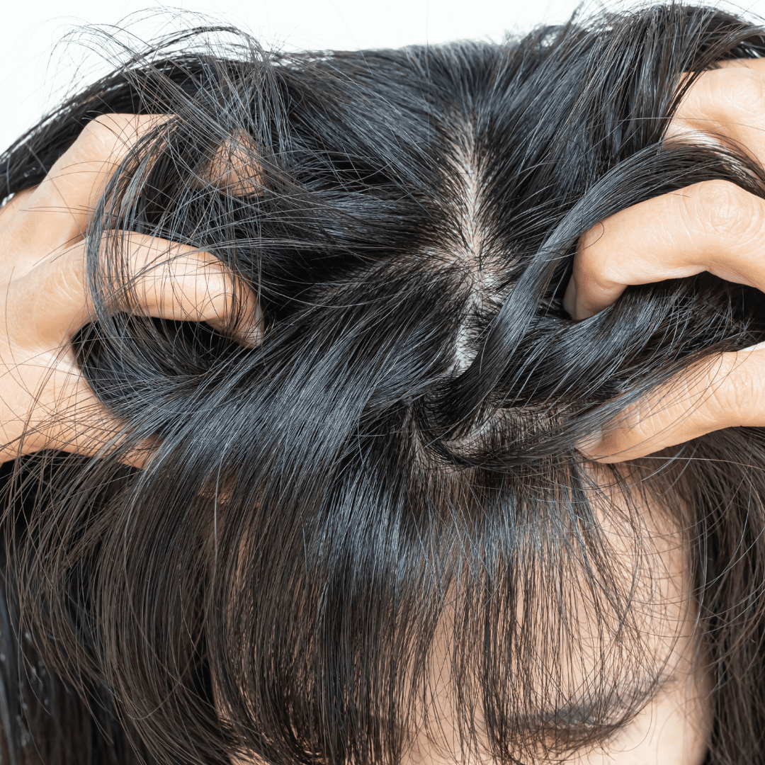 excès-de-sébum-cheveux – cuir-chevelu-gras – racines-luisantes – femme-se-touchant-les-cheveux-pour-montrer-l’excès-de-sébum